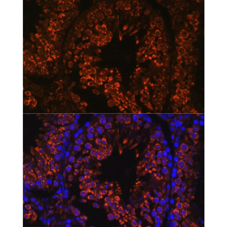 Immunofluorescence - Anti-FER1L5 Antibody (A88838) - Antibodies.com