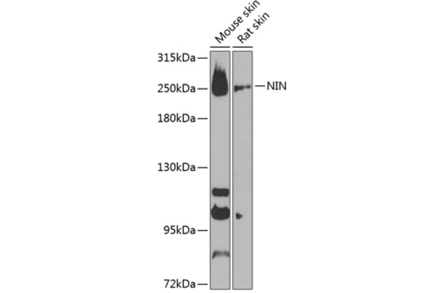 Western Blot - Anti-Ninein / NIN Antibody (A88839) - Antibodies.com