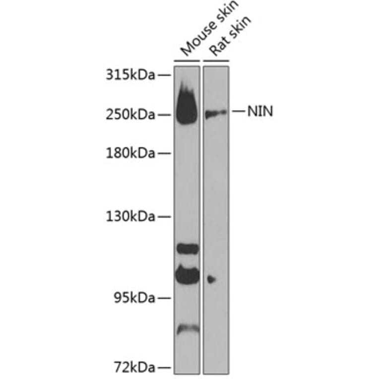 Western Blot - Anti-Ninein / NIN Antibody (A88839) - Antibodies.com