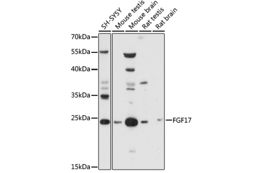Western Blot - Anti-FGF17 Antibody (A88840) - Antibodies.com