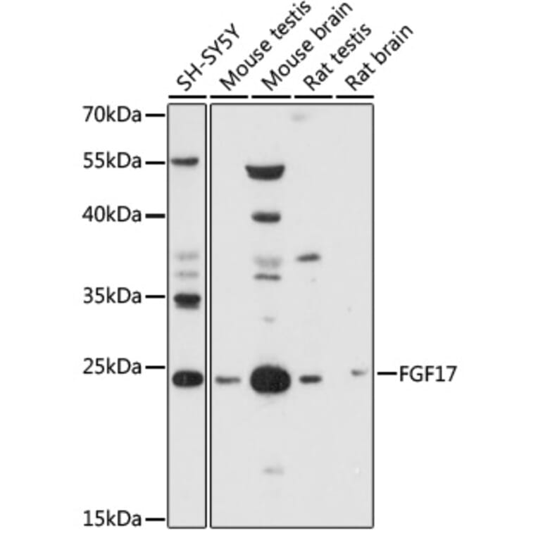 Western Blot - Anti-FGF17 Antibody (A88840) - Antibodies.com