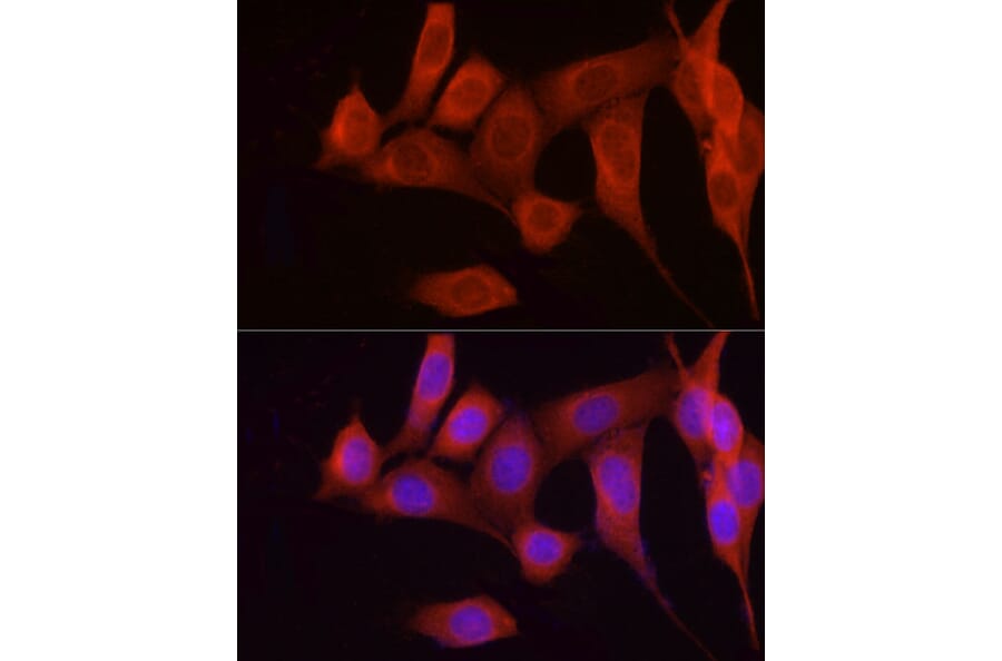 Immunofluorescence - Anti-FGF17 Antibody (A88840) - Antibodies.com