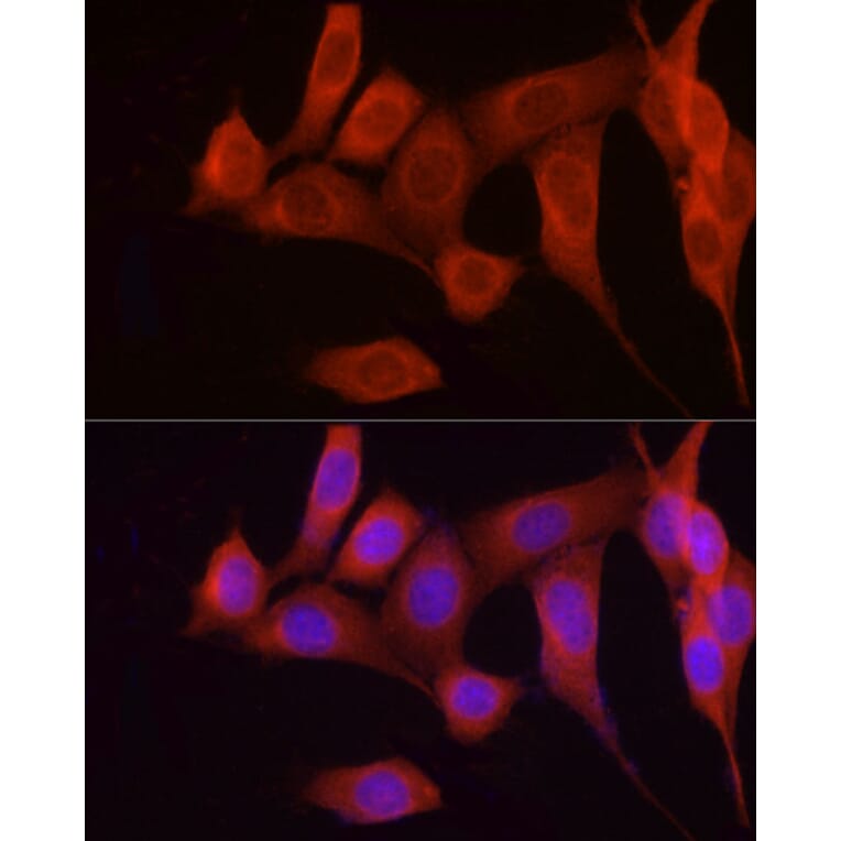 Immunofluorescence - Anti-FGF17 Antibody (A88840) - Antibodies.com