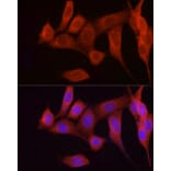 Immunofluorescence - Anti-FGF17 Antibody (A88840) - Antibodies.com