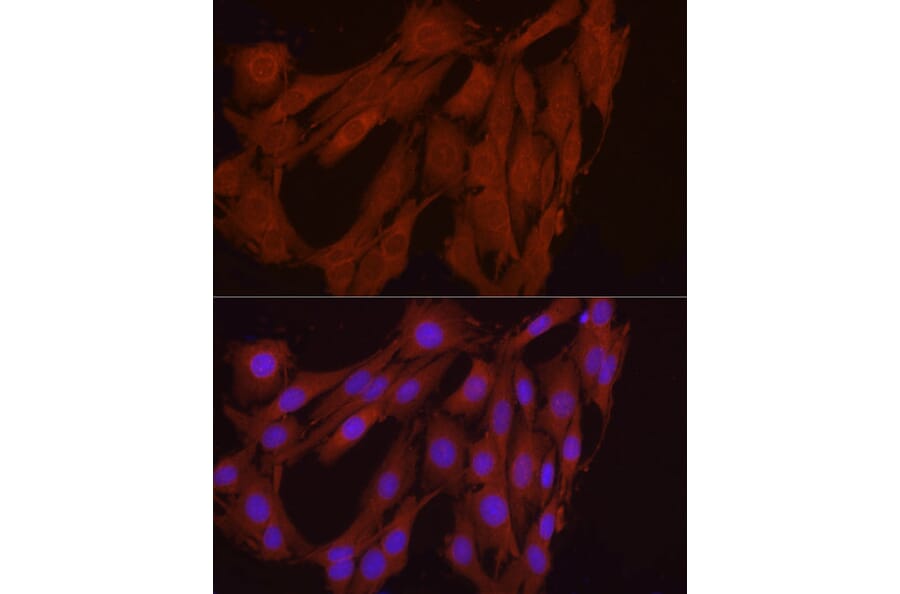 Immunofluorescence - Anti-FGF17 Antibody (A88840) - Antibodies.com