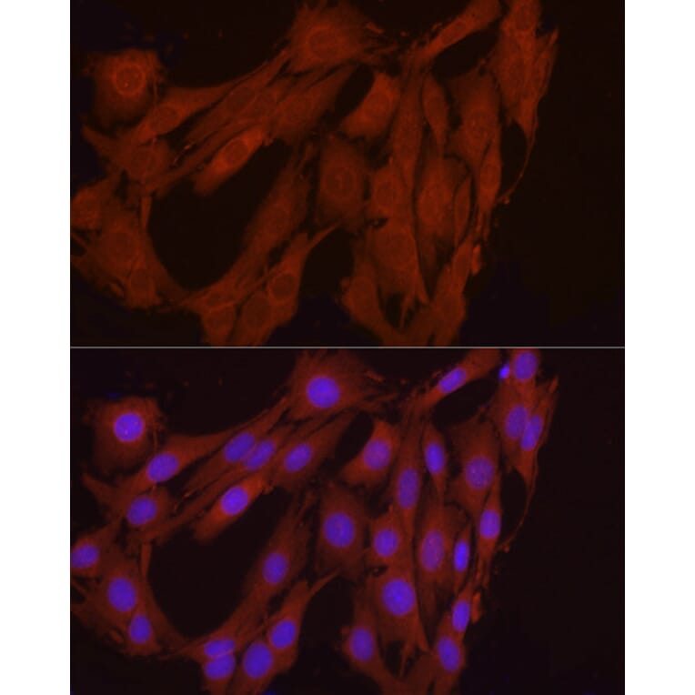 Immunofluorescence - Anti-FGF17 Antibody (A88840) - Antibodies.com