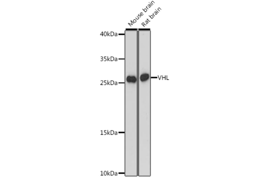 Western Blot - Anti-Von Hippel Lindau/VHL Antibody (A88841) - Antibodies.com