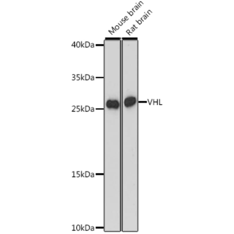 Western Blot - Anti-Von Hippel Lindau/VHL Antibody (A88841) - Antibodies.com