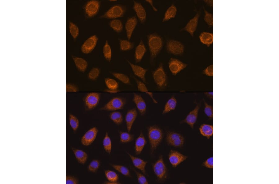 Immunofluorescence - Anti-Von Hippel Lindau/VHL Antibody (A88841) - Antibodies.com