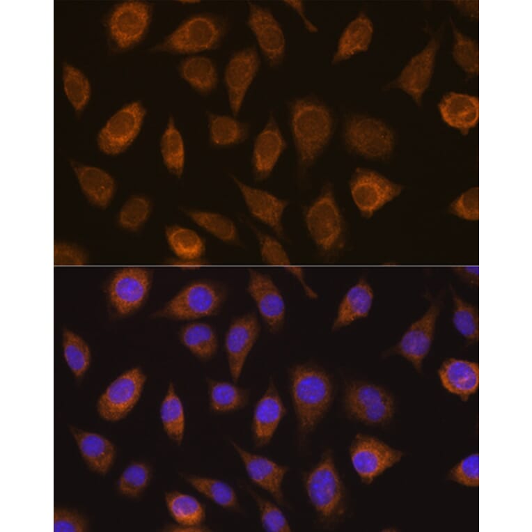 Immunofluorescence - Anti-Von Hippel Lindau/VHL Antibody (A88841) - Antibodies.com
