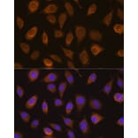 Immunofluorescence - Anti-Von Hippel Lindau/VHL Antibody (A88841) - Antibodies.com