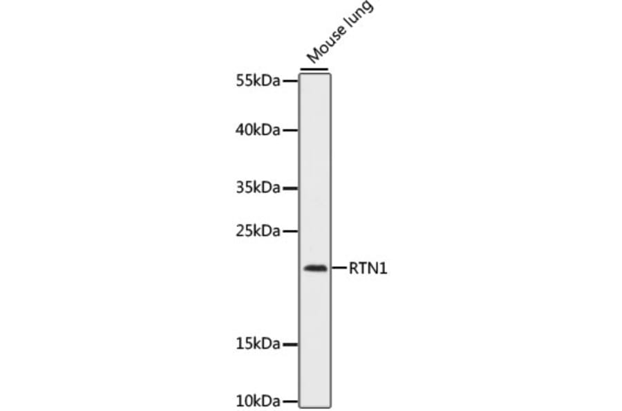 Western Blot - Anti-Reticulon 1 Antibody (A88842) - Antibodies.com