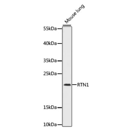 Western Blot - Anti-Reticulon 1 Antibody (A88842) - Antibodies.com