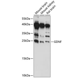 Western Blot - Anti-GDNF Antibody (A88843) - Antibodies.com