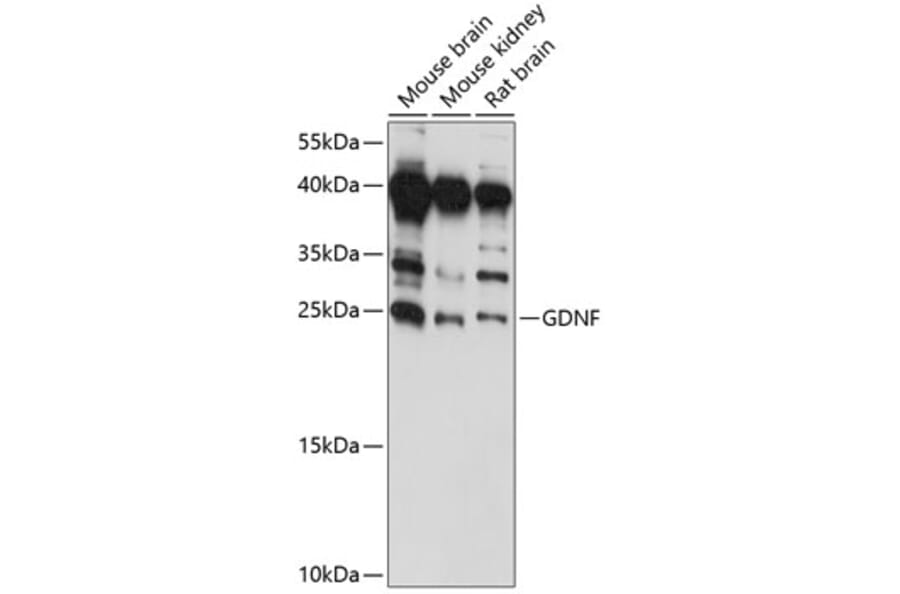 Western Blot - Anti-GDNF Antibody (A88843) - Antibodies.com