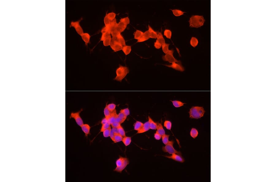 Immunofluorescence - Anti-GDNF Antibody (A88843) - Antibodies.com