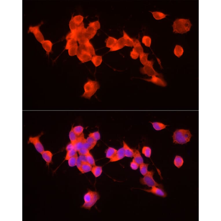Immunofluorescence - Anti-GDNF Antibody (A88843) - Antibodies.com