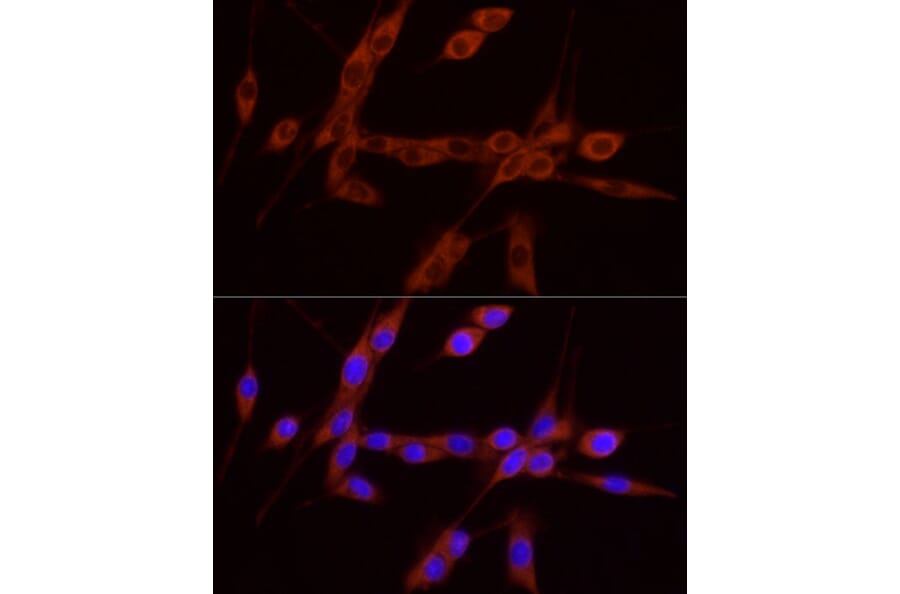 Immunofluorescence - Anti-GDNF Antibody (A88843) - Antibodies.com