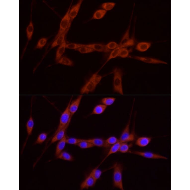 Immunofluorescence - Anti-GDNF Antibody (A88843) - Antibodies.com