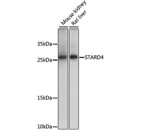 Western Blot - Anti-STARD4 Antibody (A88844) - Antibodies.com