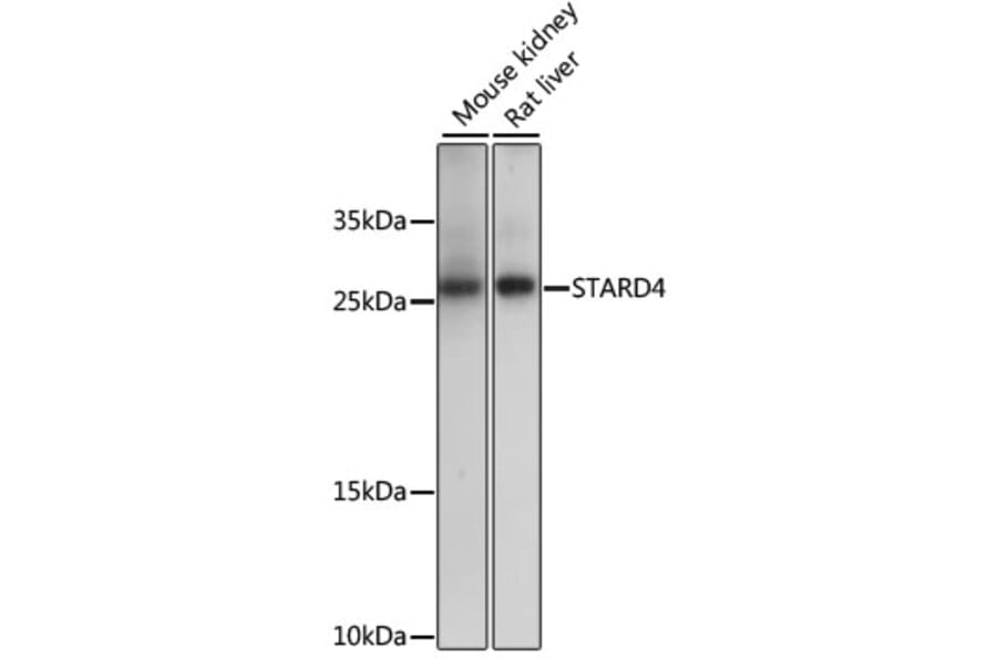 Western Blot - Anti-STARD4 Antibody (A88844) - Antibodies.com