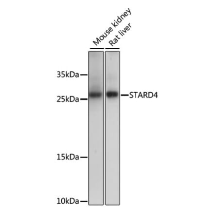 Western Blot - Anti-STARD4 Antibody (A88844) - Antibodies.com