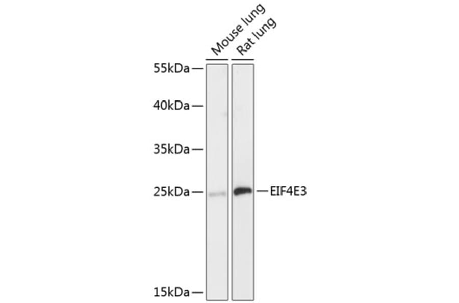 Western Blot - Anti-EIF4E3 Antibody (A88845) - Antibodies.com