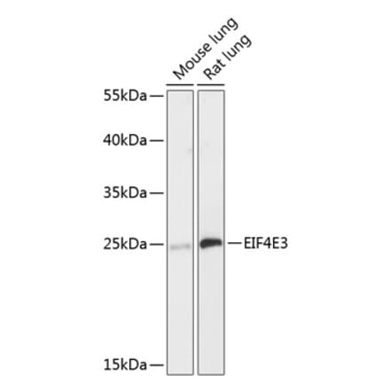 Western Blot - Anti-EIF4E3 Antibody (A88845) - Antibodies.com