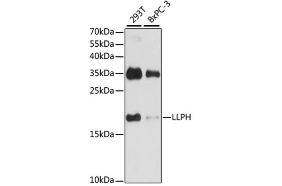 Western Blot - Anti-LLPH Antibody (A88846) - Antibodies.com