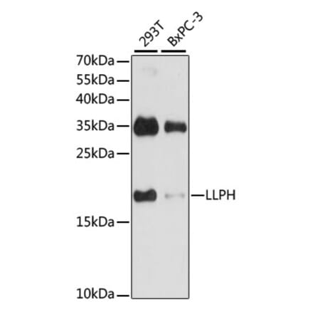 Western Blot - Anti-LLPH Antibody (A88846) - Antibodies.com
