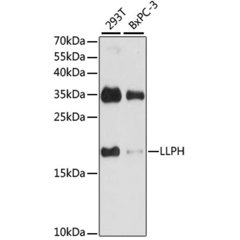 Western Blot - Anti-LLPH Antibody (A88846) - Antibodies.com