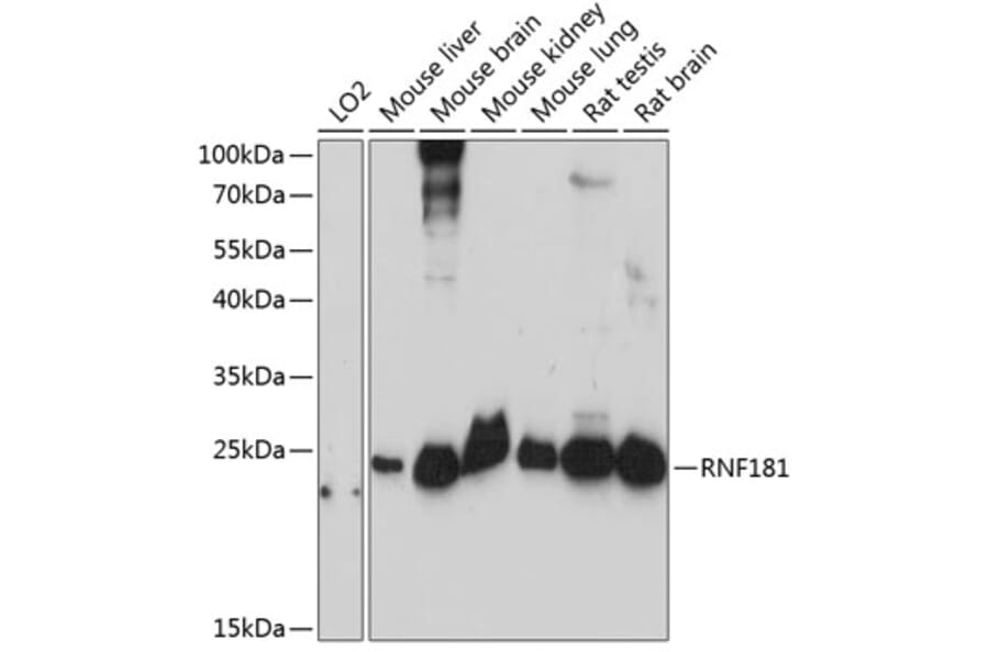 Western Blot - Anti-LOC51255 Antibody (A88847) - Antibodies.com