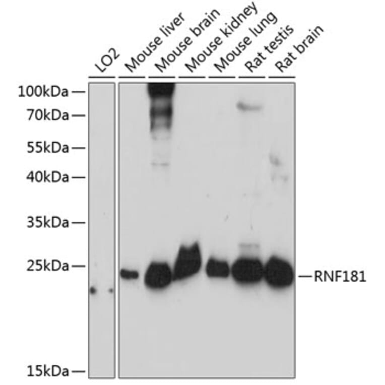 Western Blot - Anti-LOC51255 Antibody (A88847) - Antibodies.com