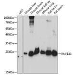 Western Blot - Anti-LOC51255 Antibody (A88847) - Antibodies.com