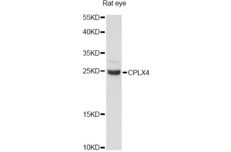 Western Blot - Anti-CPLX4 Antibody (A14464) - Antibodies.com