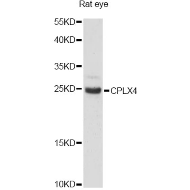 Western Blot - Anti-CPLX4 Antibody (A14464) - Antibodies.com