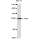 Western Blot - Anti-CPLX4 Antibody (A14464) - Antibodies.com