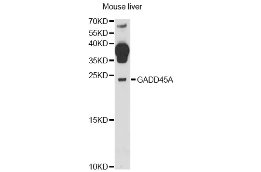 Western Blot - Anti-GADD45A Antibody (A13486) - Antibodies.com