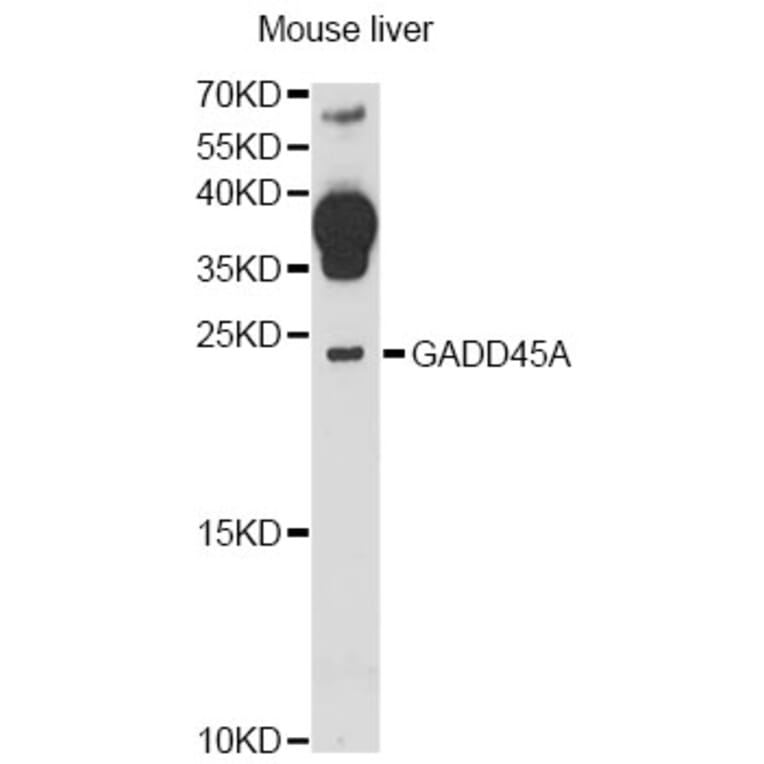 Western Blot - Anti-GADD45A Antibody (A13486) - Antibodies.com