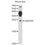 Western Blot - Anti-GADD45A Antibody (A13486) - Antibodies.com