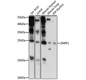Western Blot - Anti-ZNRF1 Antibody (A88850) - Antibodies.com