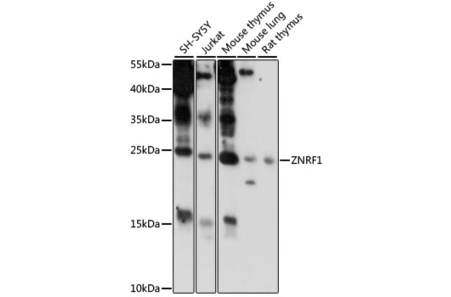 Western Blot - Anti-ZNRF1 Antibody (A88850) - Antibodies.com