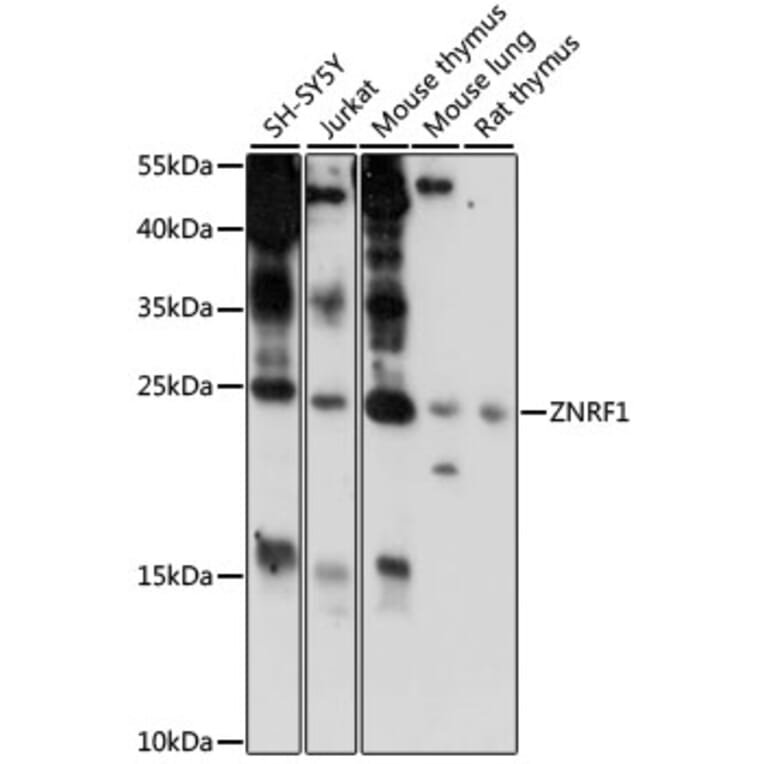 Western Blot - Anti-ZNRF1 Antibody (A88850) - Antibodies.com