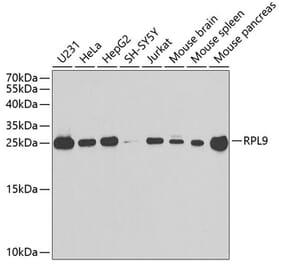 Western Blot - Anti-RPL9 Antibody (A88851) - Antibodies.com