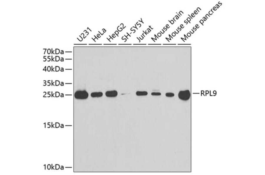 Western Blot - Anti-RPL9 Antibody (A88851) - Antibodies.com