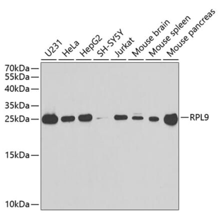 Western Blot - Anti-RPL9 Antibody (A88851) - Antibodies.com