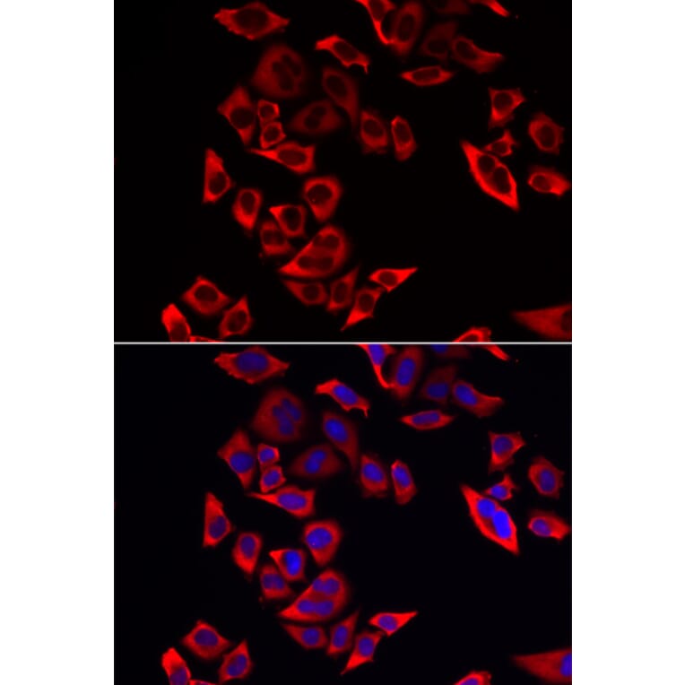 Immunofluorescence - Anti-RPL9 Antibody (A88851) - Antibodies.com