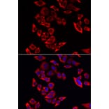 Immunofluorescence - Anti-RPL9 Antibody (A88851) - Antibodies.com
