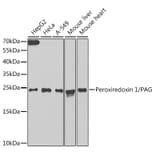 Western Blot - Anti-Peroxiredoxin 1/PAG Antibody (A88852) - Antibodies.com