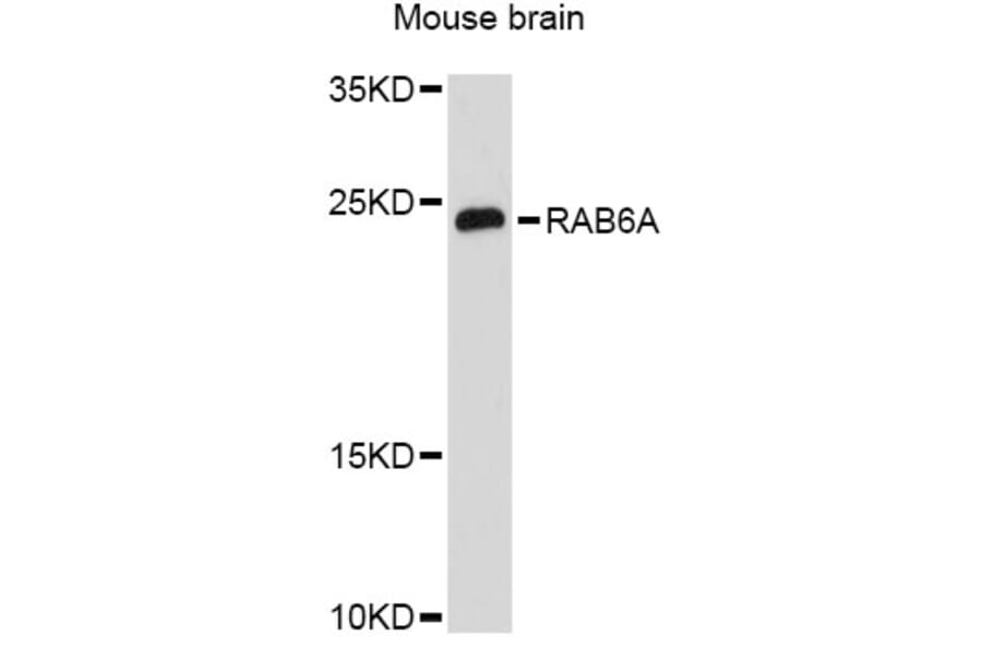 Western Blot - Anti-RAB6A Antibody (A12089) - Antibodies.com